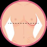 Saggy Bust